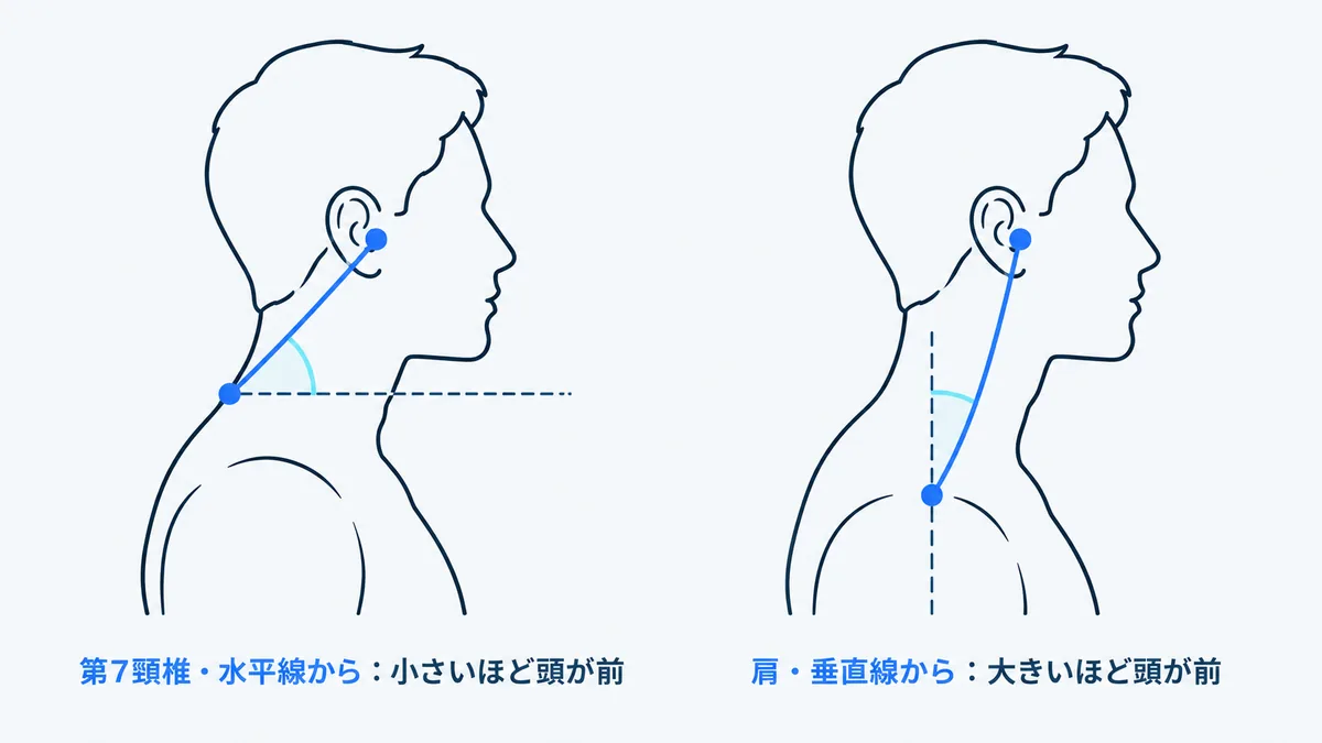 2つの横向きの図。左は第7頸椎で水平線から測る角度、右は肩で垂直線から測る角度