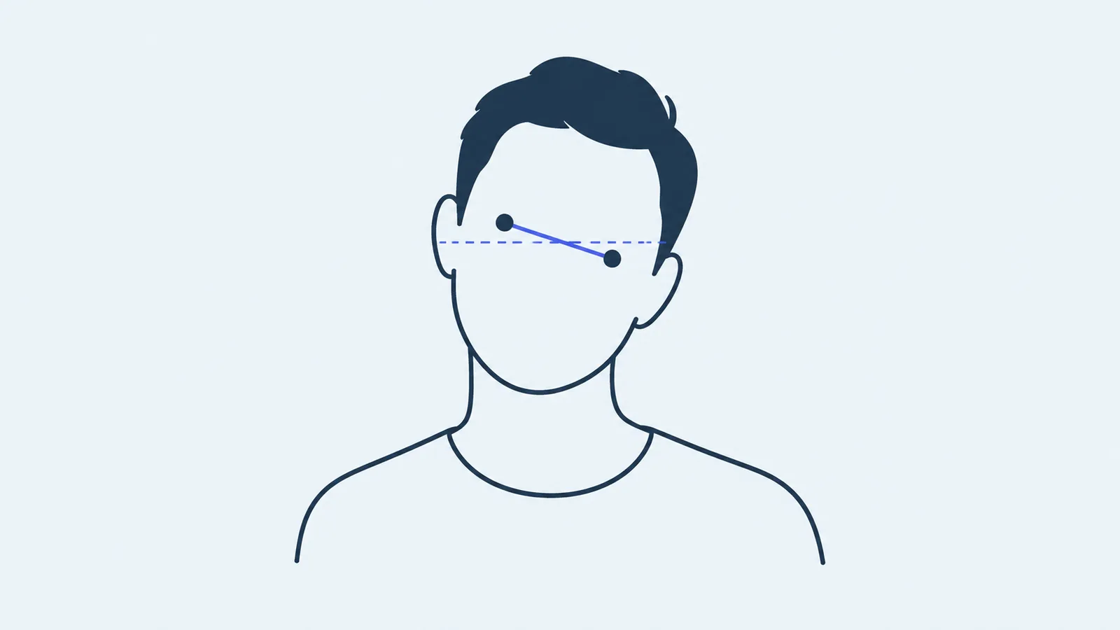 Front view of a person's head leaning slightly to one side, with a sloping line through both eyes next to a level reference line