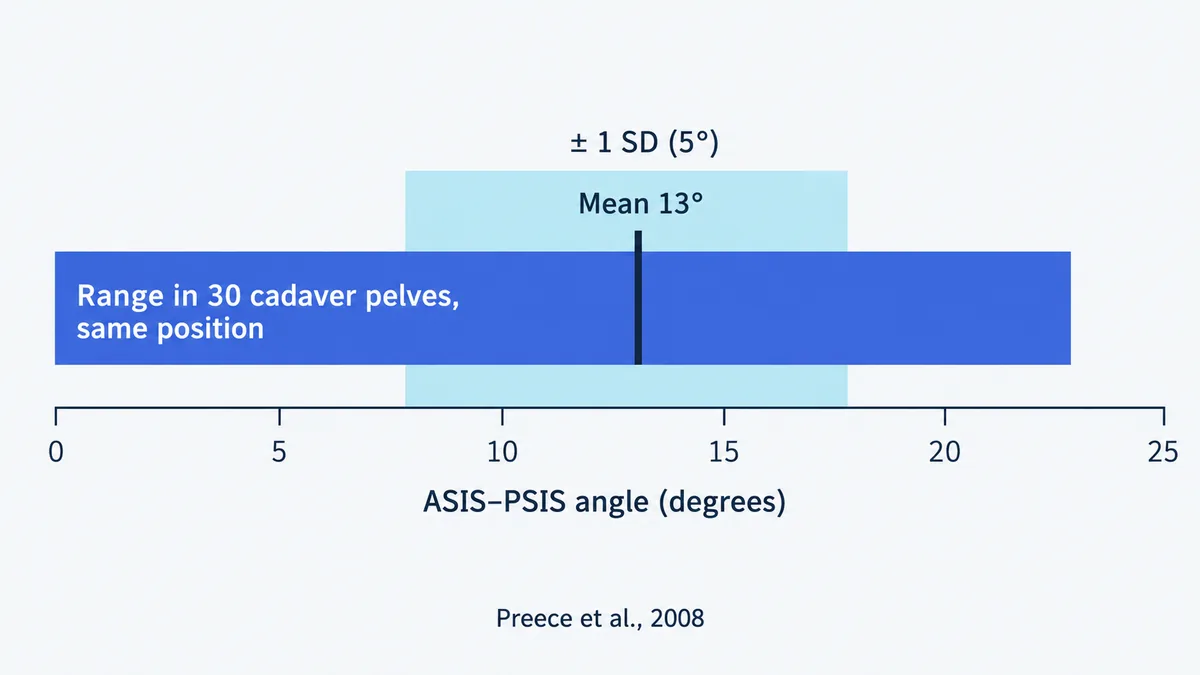 Range chart: in 30 cadaver pelves held in the same position, the ASIS–PSIS angle ranged from 0° to 23°, mean 13°