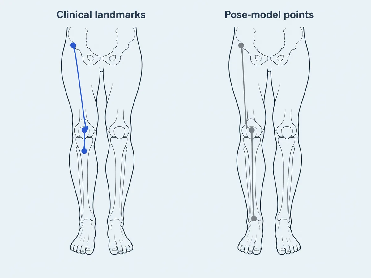 Two legs: one with the three clinical Q angle landmarks, one with the hip, knee and ankle points a pose model estimates
