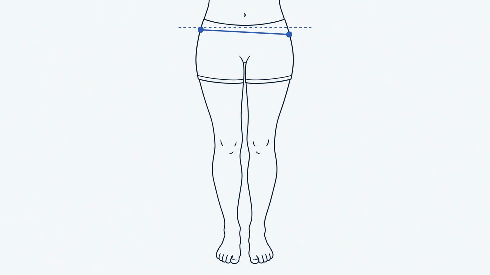 Illustration of legs and hips from the front with a slightly tilted line across the hips